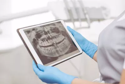 digital dental x-rays