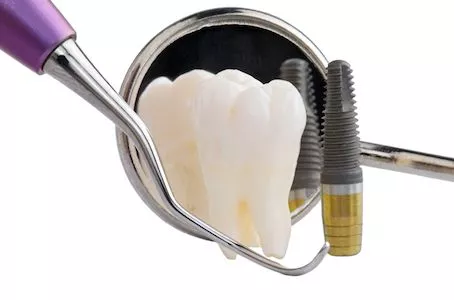 dental implant and dental tools